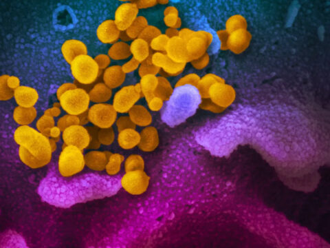 COVID-19'un beyindeki "sessiz" izi: Siz iyileştiğinizi sanıyorsunuz ama…